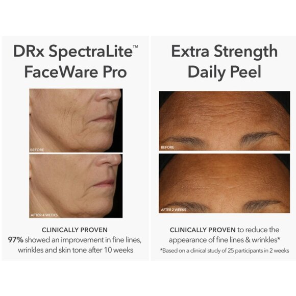 Dr. Dennis Gross Plump Glow Collagen Boost FaceWare Pro Mask Set Pink - Limited - Picture 15 of 15